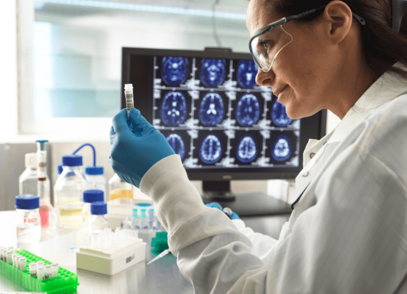 Alzheimer's disease research